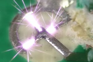 PCB Spark Gap Nedir? Kıvılcım Boşluğu